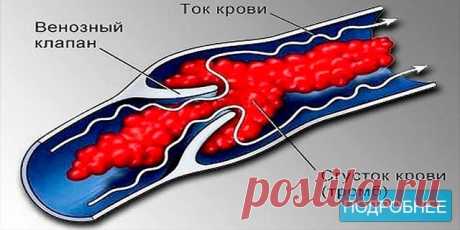 Не хочешь тромбов, просто пей этот коктейль - ПОЛЕЗНЫЕ СОВЕТЫ Народная медицина предлагает универсальный коктейль от многих заболеваний. Нужно смешать в одной бутылке (желательно тёмного стекла) аптечные настойки: