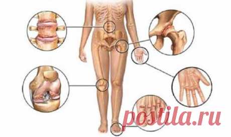 Лучшее средство для лечения артрита, ревматизма и суставов! — Жизнь под Лампой!