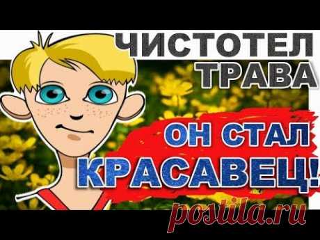 Как стать красавцем навсегда. Топ рецепт - что лечит чистотел за копейки!