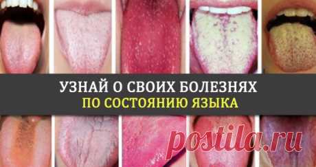 Проверь свое здоровье по состоянию языка! | KaifZona.Ru