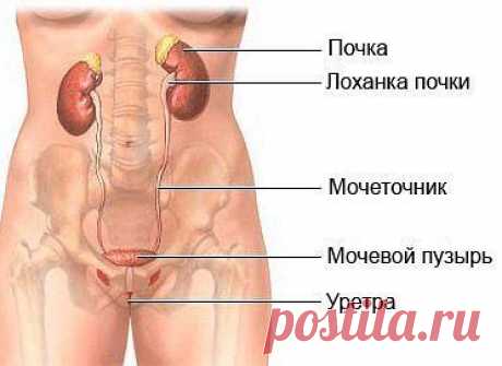 Как бороться с циститом в домашних условиях