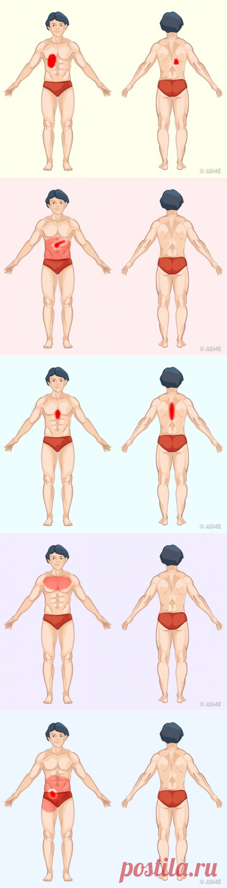 9 способов определить причину боли по месту ее локализации
