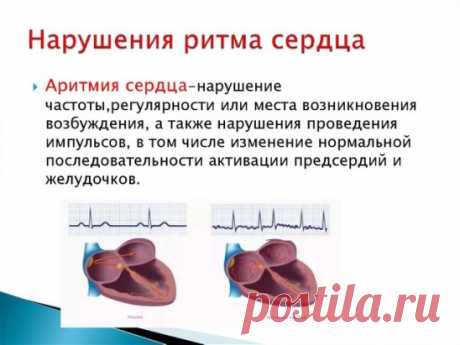 КАК ПОМОЧЬ СЕБЕ ПРИ АРИТМИИ
Экстрасистолия - наиболее часто встречающаяся форма сердечных аритмий. Она может возникать не только в результате сердечных недугов, но и при заболеваниях желудочно-кишечного тракта, мочеполовой системы, остеохондрозе позвоночника, эндокринных нарушениях.
Причиной возникновения экстрасистолии (даже у здорового человека) может быть стресс, переутомление, злоупотребление лекарствами, кофе, курением, алкоголем.
Основными симптомами болезни являются «замирание сердца»,