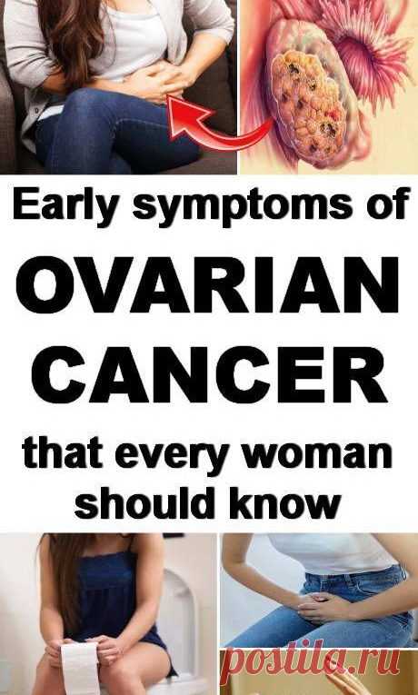 Early Symptoms of Ovarian Cancer