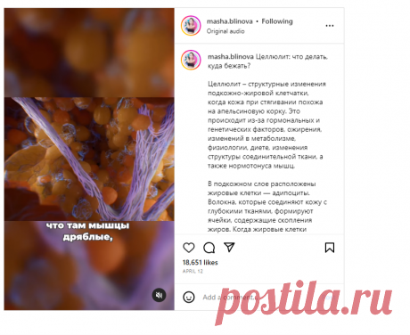 Фитнес тренер Маша Блинова on Instagram: “Целлюлит: что делать, куда бежать? Целлюлит – структурные изменения подкожно-жировой клетчатки, когда кожа при стягивании похожа на…”