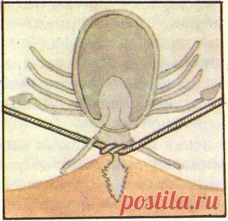 6 советов ЧТО ДЕЛАТЬ, если к телу ПРИСОСАЛСЯ КЛЕЩ? | Познавательный сайт ,,1000 мелочей&quot;
