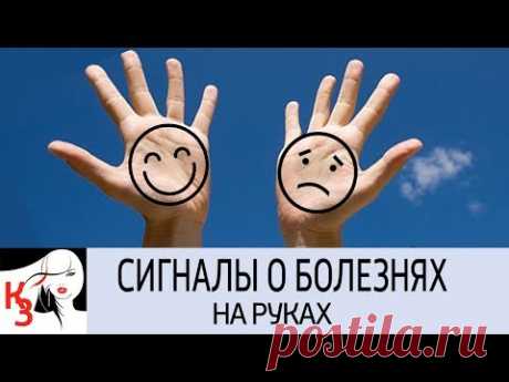 О ЧЕМ ГОВОРЯТ НАШИ ЛАДОНИ. Какие болезни можно распознать - YouTube