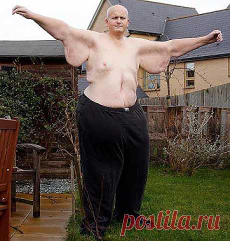 Самое интересное в мире: Самый толстый мужчина планеты похудел на... - natali5357@mail.ru - Почта Mail.Ru