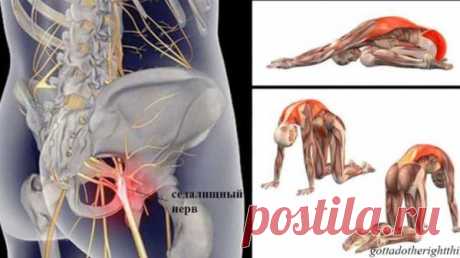 11 упражнений, которые избавят вас от боли в спине , когда воспалился седалищный нерв