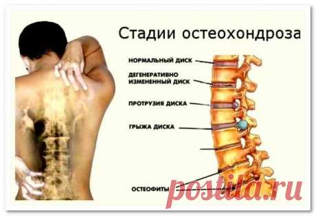 Болит спина в области почек - возможные причины и лечение!