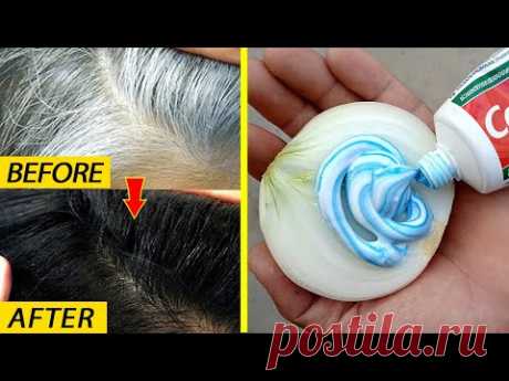 White hair to black hair naturally permanently with onion | 100% Effective