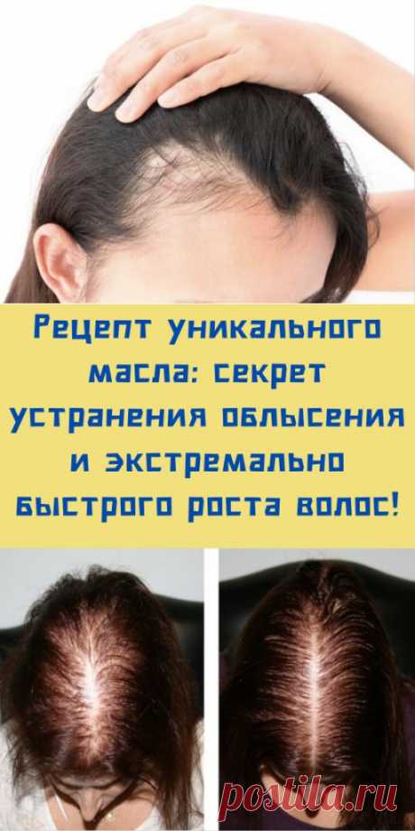 Рецепт уникального масла: секрет устранения облысения и экстремально быстрого роста волос! - likemi.ru