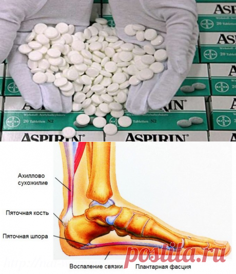 Целебный раствор аспирина от шпор, варикоза и остеохондроза - Что хочет женщина