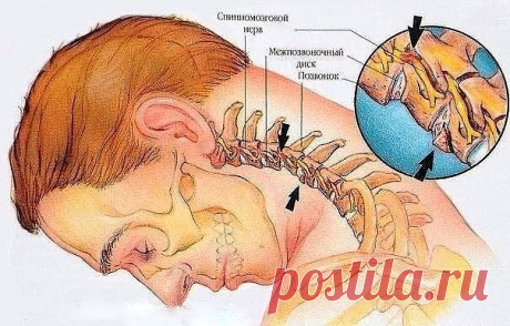 (46) Одноклассники