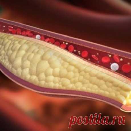 Антихолестириновый чай из подорожника - МирТесен