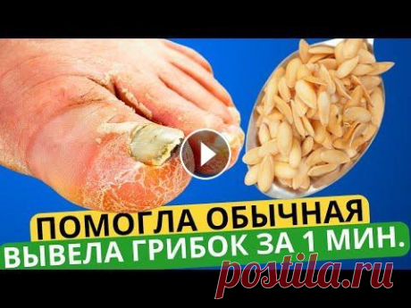 Эта ЯДРЁНАЯ Мазь Разъест Весь Грибок с Ногтей За 1 Минуту! Это точно есть у каждого дома! Сотрудничество - progresswayvideos@gmail.com ✎﹏﹏﹏﹏﹏﹏﹏﹏﹏﹏﹏﹏﹏﹏ ➤ВНИМАНИЕ! Канал носит исключительно информационный характер. Все рекомендации должны быт...