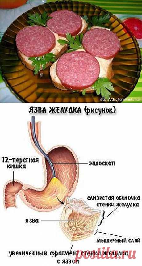 Какая еда нарушает кислотно-щелочной баланс и какая нормализует?.