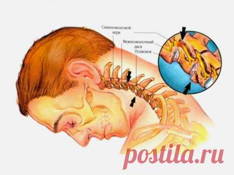 8 упражнений против шейного остеохондроза