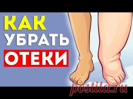 Как убрать ОТЁКИ на ногах? Как убрать отёки на лице? Как убрать мешки под глазами?