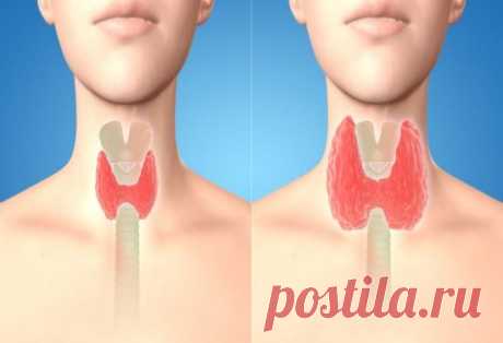 Привести Щитовидку в норму за 8 дней с помощью семян кориандра