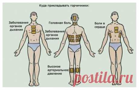 Как правильно ставить горчичники