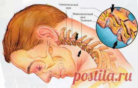 Семь простых упражнений для лечения шейного остеохондроза
