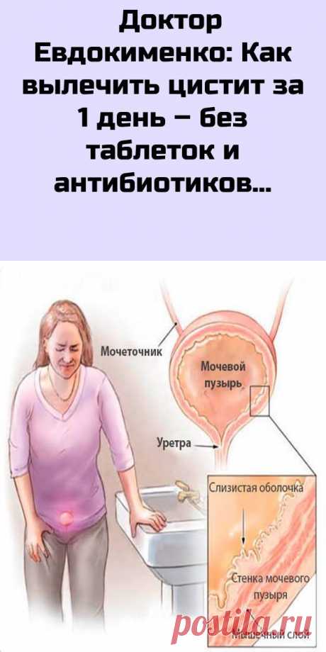 Доктор Евдокименко: Как вылечить цистит за 1 день – без таблеток и антибиотиков
Ни для кого не секрет, что многие женщины часто страдают от цистита — особенно в холодное время года. Учащенное мочеиспускание, рези при мочеиспускании – все это очень неприятно. В этой статье доктор Евдокименко расскажет как вылечить цистит за один день. Народная медицина — рецепты, советы, способы, cекреты и народные средства.