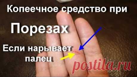 Как я лечу за 1 день воспаление и гнойный нарыв на пальце. Быстро Легко и 100% без лекарств