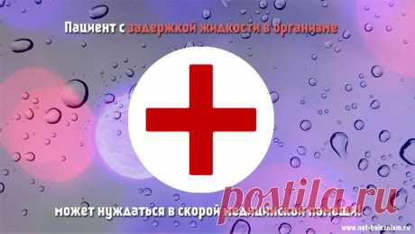 От чего отекают ноги и как вывести жидкость из организма?

Отеки могут указать на серьёзное заболевание, даже если на первый взгляд все кажется нормальным.

Для того чтобы устранить сомнения и возможные риски, в случае отеков, рекомендуется пройти обследование.