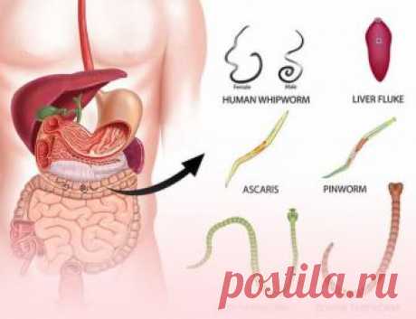 Тыквенные семечки от паразитов: Как принимать Среди кишечных глистов наиболее распространены острицы, аскариды и ленточные черви. Токсины из этих кишечных паразитов могут привести к нарушению иммунной системы, хроническим заболеваниям, нарушению ...
