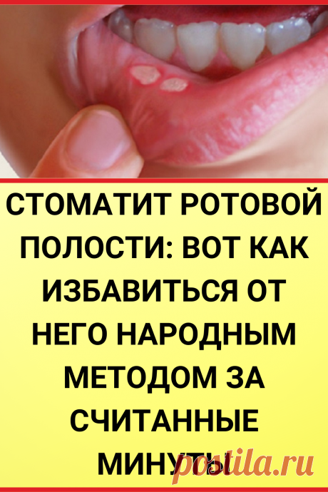 Стоматит ротовой полости: вот как избавиться от него народным методом за считанные минуты, без каких-либо медикаментов!