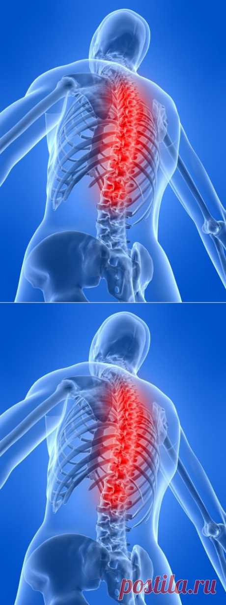 Шесть заблуждений о лечении спины