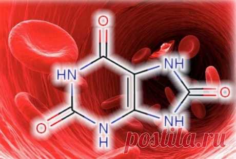 - Как снизить уровень мочевой кислоты -