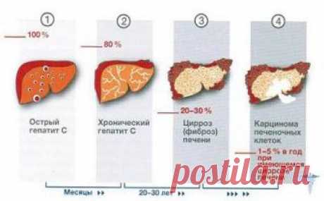 Гепатит С: симптомы и лечение, сколько живут