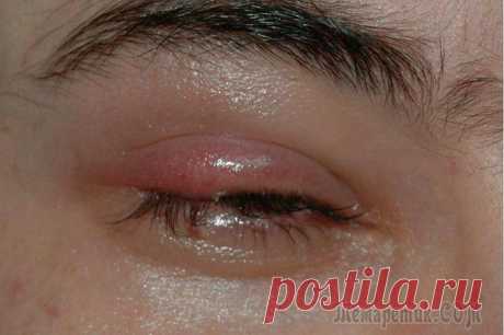 10 серьезных болезней, которые можно продиагностировать по глазам