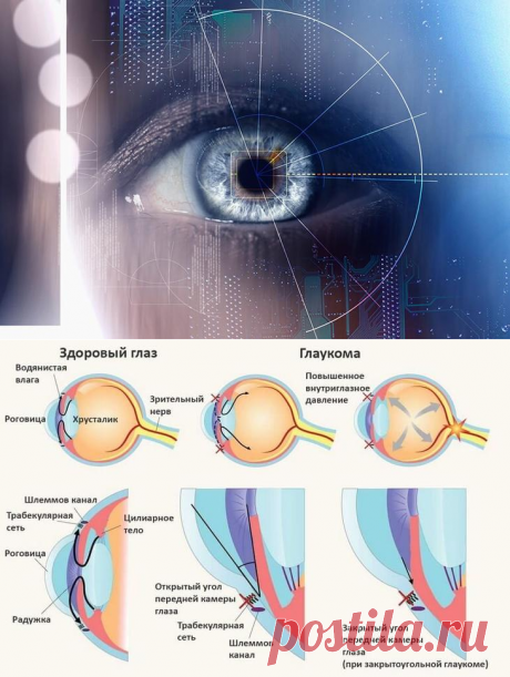 Глаукома: натуральные средства, которые помогут облегчить состояние...