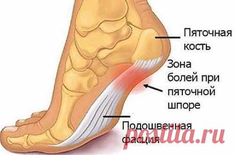 РЕЦЕПТ ЛЕЧЕНИЕ ШИШЕК И ПЯТОЧНОЙ ШПОРЫ 

Посылаю вам рецепт лечения пяточной шпоры и шишек возле большого пальца ноги. Его мне дал молодой врач лет 15 назад. Он сказал: «Больничный лист по этому поводу я выписать не могу, не положено. Но моя бабушка лечилась от этих неприятностей так:...» Я взяла на вооружение совет его бабушки, вылечилась сама и много женщин на работе вылечила. 

Рецепт очень простой и недорогой. З—4 горсти морской соли (можно и поваренной если капнуть в н...