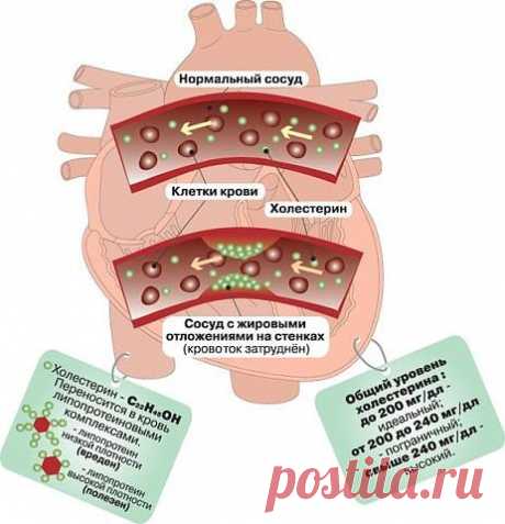Очищаем сосуды от холестерина в домашних условиях – """ПОМОГИ СЕБЕ САМ, пользователь Елена Светлая | Группы Мой Мир