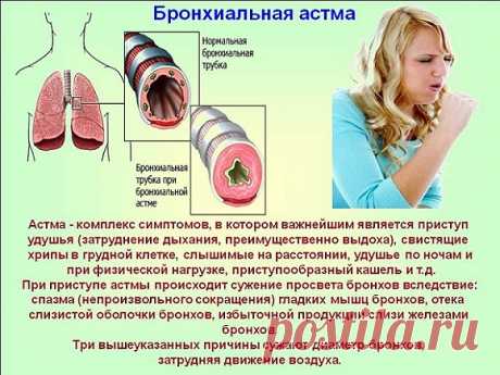 Десять вдохов и выдохов.
Поделюсь с читателями упражнением, снимающим спазмы бронхов, 
облегчающим приступы астмы и прочищающим носовые проходы. С помощью 
него мне удалось добиться облегчения состояния при бронхиальной астме, 
которой страдаю.