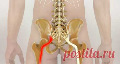 Как разблокировать седалищный нерв: 2 простых способа снять боль. | Новости | Всеукраинская ассоциация пенсионеров