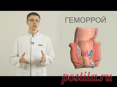 геморрой лечение, диагностика, полезные советы