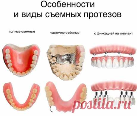 таблицы цен на съемные протезы из металлокерамики цена: 2 тыс изображений найдено в Яндекс Картинках