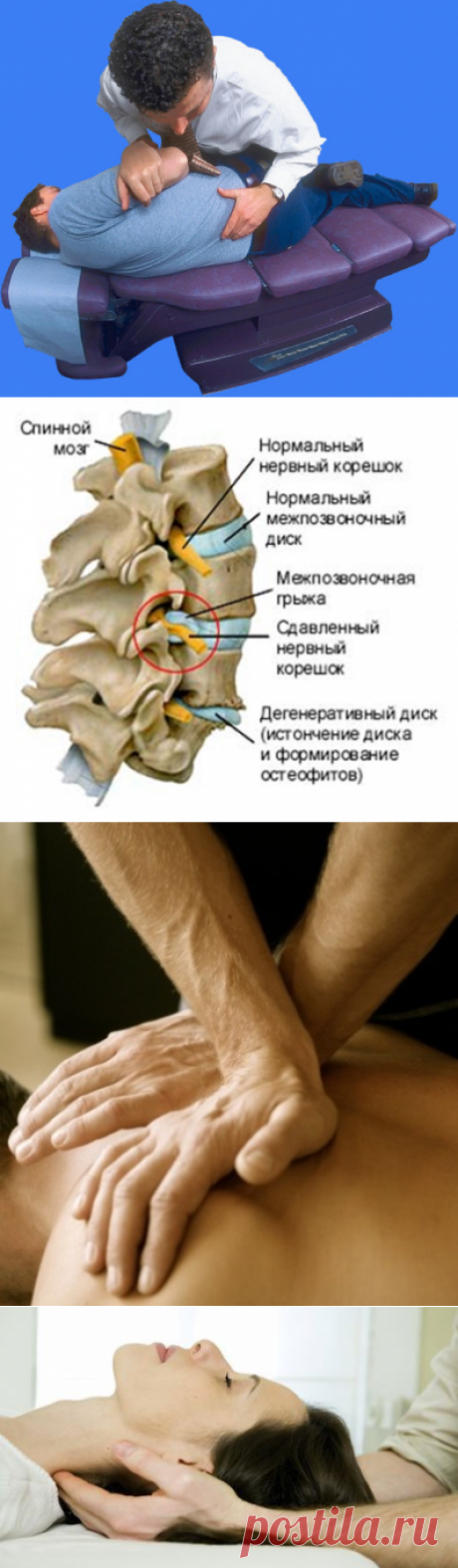 Мануальная терапия Спб Калининский район цена +7-931-360-16-23 / Мануальная терапия позвоночника при грыже протрузии у м.Академическая недорого