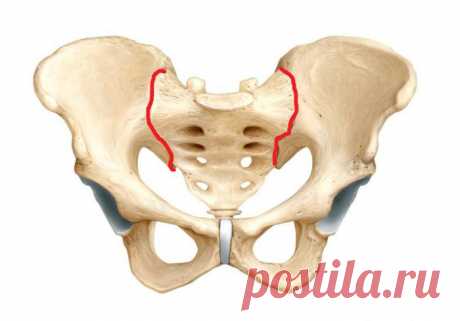 Сакроилеит - что это такое? Сакроилеит: симптомы, причины, лечение