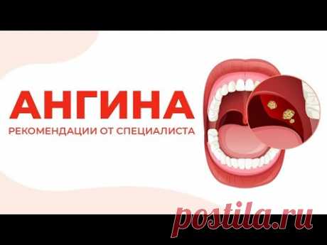 АНГИНА - Рекомендации от специалиста | Александр Романенко