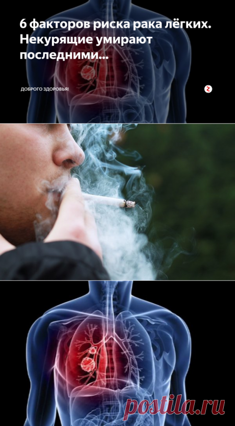 6 факторов риска рака лёгких. Некурящие умирают последними... | Доброго здоровья! | Яндекс Дзен