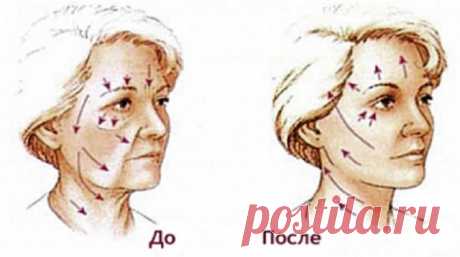 Этот способ помог мне быстро подтянуть кожу лица и избавиться от морщин!