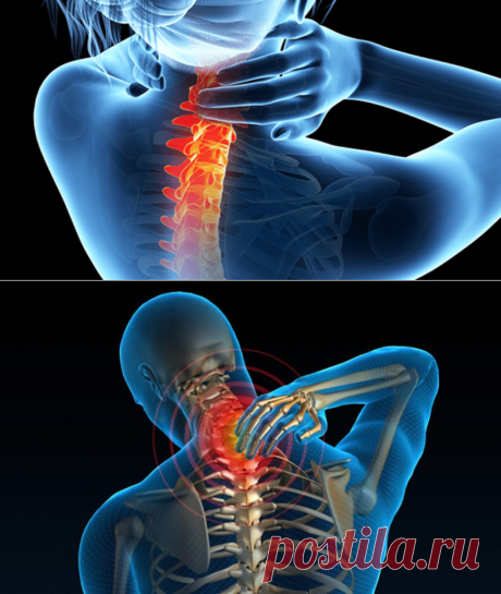 5 упражнений от хронической боли в шее — лучше, чем лекарство! / Будьте здоровы