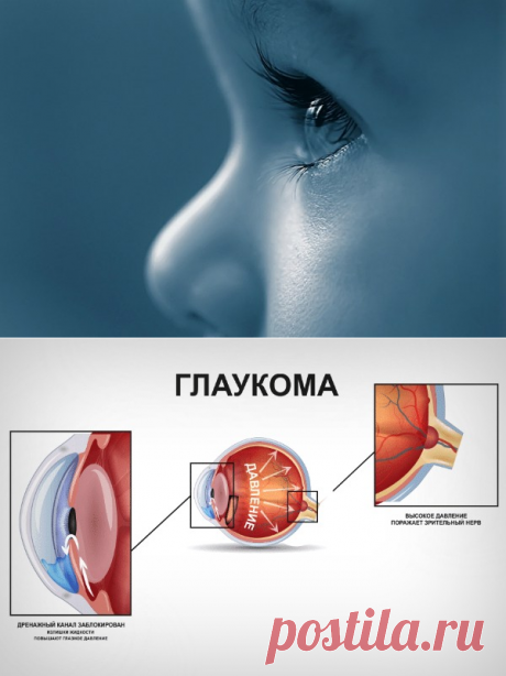 Почему возникает врожденная глаукома и насколько она опасна для зрения ребенка