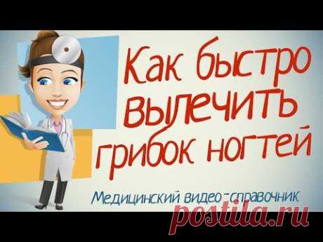 ▶ Как лечить грибок ногтей народными средствами - YouTube